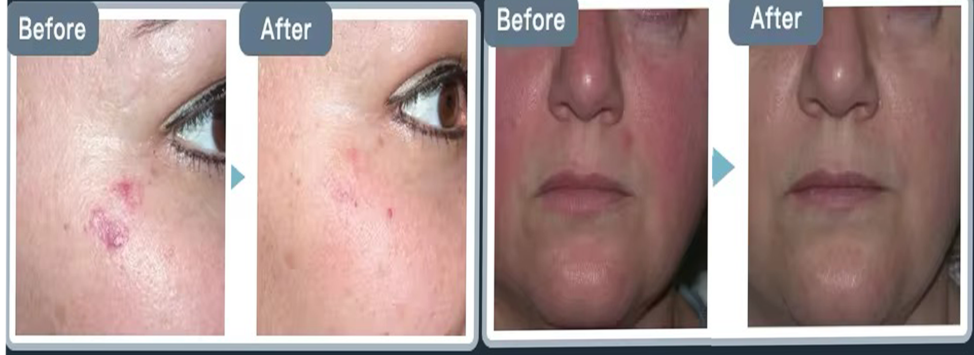 980 vascular clinical.png