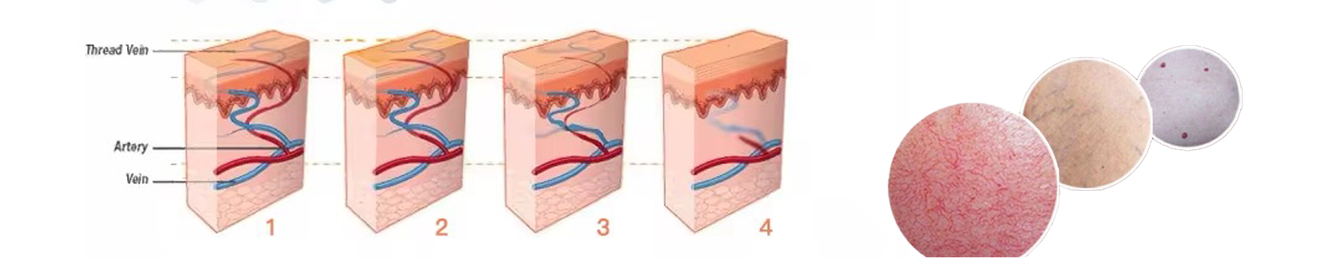 980 vascular theory.png